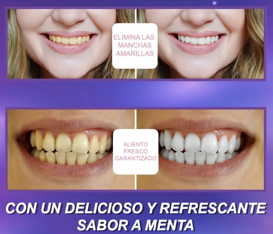 2 x1 Smilekit® Blanquea tus dientes fácil y rápido